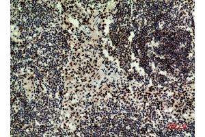 Immunohistochemistry (IHC) analysis of paraffin-embedded Human Lymph Nodes, antibody was diluted at 1:100. (HDGFRP3 antibody  (Internal Region))