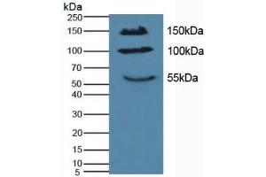 Detection of IL17RA in Mouse Pancreas Tissue using Polyclonal Antibody to Interleukin 17 Receptor A (IL17RA) (IL17RA antibody  (AA 590-848))