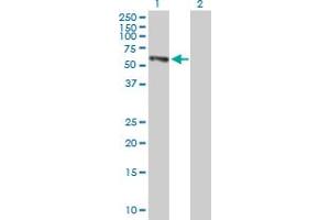 Western Blot analysis of EPHX2 expression in transfected 293T cell line by EPHX2 MaxPab polyclonal antibody. (EPHX2 antibody  (AA 1-555))
