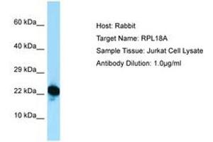 Image no. 1 for anti-Ribosomal Protein L18a (RPL18A) (C-Term) antibody (ABIN6749890) (RPL18A antibody  (C-Term))