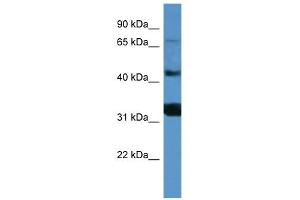 WB Suggested Anti-MFI2 Antibody Titration: 0. (MFI2 antibody  (C-Term))