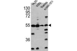 Western Blotting (WB) image for anti-Caspase 2, Apoptosis-Related Cysteine Peptidase (CASP2) antibody (ABIN2997249) (Caspase 2 antibody)
