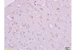 Formalin-fixed and paraffin embedded mouse kidney tissue labeled with Anti CRHR2/Corticotropin Releasing Factor Receptor 2 Polyclonal Antibody, Unconjugated (ABIN680773) at 1:200 followed by conjugation to the secondary antibody and DAB staining (CRHR2 antibody  (AA 51-150))
