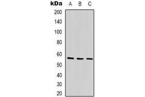 Western blot analysis of ANGPTL1 expression in Jurkat (A), MCF7 (B), K562 (C) whole cell lysates.