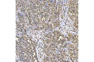 IHC analysis of SART1 using anti-SART1 antibody (ABIN7599884). (SART1 antibody  (AA 125-800))