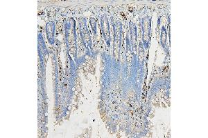 IHC analysis of COPE using anti-COPE antibody (ABIN7602509). (COPE antibody  (AA 80-308))