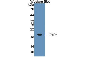 Figure. (CRABP1 antibody  (AA 2-137))