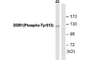 Western blot analysis of extracts from 3T3 cells, using DDR1 (Phospho-Tyr513) Antibody. (DDR1 antibody  (pTyr513))
