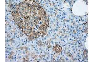 Immunohistochemical staining of paraffin-embedded liver tissue using anti-ALDH3A1 mouse monoclonal antibody. (ALDH3A1 antibody)