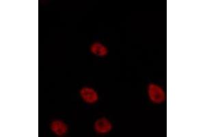 ABIN6275635 staining HepG2 by IF/ICC. (TCEAL6 antibody)