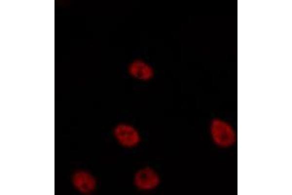 TCEAL6 antibody
