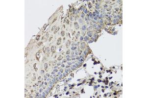 Immunohistochemistry of paraffin-embedded human esophagus using GBF1 antibody. (GBF1 antibody)
