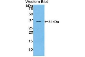 Western Blotting (WB) image for anti-Protein tyrosine Phosphatase, Receptor Type, J (PTPRJ) (AA 567-842) antibody (ABIN3206457) (PTPRJ antibody  (AA 567-842))