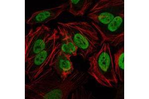 Immunofluorescence analysis of Hela cells using PRKDC mouse mAb (green).