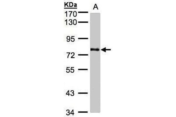 GALNT6 antibody