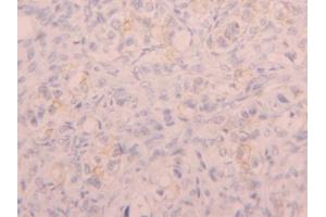 DAB staining on IHC-P; Samples: Human Ovary Tissue (CD5L antibody  (AA 133-256))