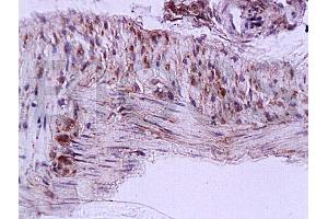 Formalin-fixed and paraffin embedded rat colon tissue labeled with Anti-Cygb Polyclonal Antibody (ABIN670566), Unconjugated at 1:200, followed by conjugation to the secondary antibody and DAB staining (CYGB antibody  (AA 87-132))