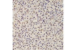 Immunohistochemistry of paraffin-embedded Human amygdalitis using ANP32A antibody at dilution of 1:100 (x400 lens).
