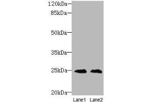 Western blot All lanes: TIMP3 antibody at 2 μg/mL Lane 1: EC109 whole cell lysate Lane 2: 293T whole cell lysate Secondary Goat polyclonal to rabbit IgG at 1/10000 dilution Predicted band size: 25 kDa Observed band size: 25 kDa (TIMP3 antibody  (AA 30-208))