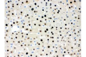 Immunohistochemistry (Paraffin-embedded Sections) (IHC (p)) image for anti-Retinoblastoma Binding Protein 4 (RBBP4) (AA 395-425), (C-Term) antibody (ABIN3043920) (Retinoblastoma Binding Protein 4 antibody  (C-Term))