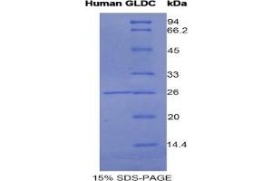 SDS-PAGE of Protein Standard from the Kit (Highly purified E. (GLDC ELISA Kit)
