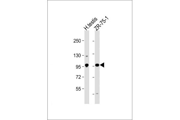 STK31 antibody  (C-Term)