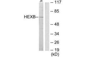 Western blot analysis of extracts from Jurkat cells, using HEXB antibody. (HEXB antibody  (C-Term))
