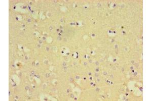Immunohistochemistry of paraffin-embedded human brain tissue using ABIN7174112 at dilution of 1:100