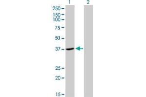 Western Blot analysis of ADH4 expression in transfected 293T cell line by ADH4 monoclonal antibody (M01), clone 3C5. (ADH4 antibody  (AA 52-150))