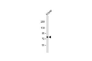 Anti-PCCA Antibody (Center) at 1:2000 dilution + human liver lysate Lysates/proteins at 20 μg per lane. (PCCA antibody  (AA 362-390))