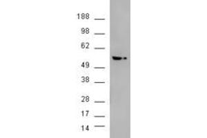 HEK293 overexpressing AKT3 (ABIN5421464) and probed with ABIN185314 (mock transfection in second lane).