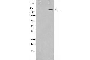 Western blot analysis on HuvEc cell lysate using Sodium Channel-pan Antibody,The lane on the left is treated with the antigen-specific peptide. (Sodium Channel-Pan antibody)