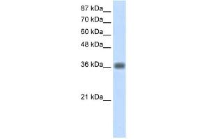 WB Suggested Anti-KLHDC8A Antibody Titration:  1.