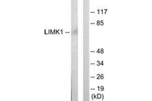 Western blot analysis of extracts from mouse brain cells, using LIMK1 Antibody. (LIM Domain Kinase 1 antibody  (AA 461-510))