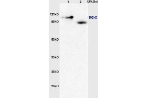 Lane 1: mouse brain lysates Lane 2: human colon carcinoma lysates probed with Anti GRM4/mGluR4 Polyclonal Antibody, Unconjugated (ABIN735998) at 1:200 in 4 °C. (GRM4/6 antibody  (AA 301-400))