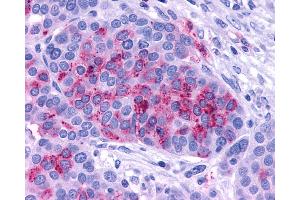 Immunohistochemistry (IHC) image for anti-Adenylate Cyclase Activating Polypeptide 1 (Pituitary) Receptor Type I (ADCYAP1R1) (C-Term) antibody (ABIN1048299)