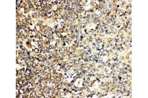Anti-IL3 antibody, IHC(P) IHC(P): Human Tonsil Tissue (IL-3 antibody  (N-Term))