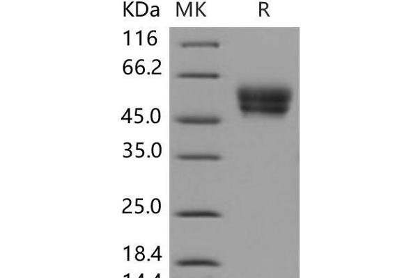 Cell Adhesion Molecule 4 Protein (CADM4) (His tag)