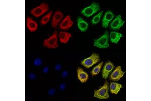 ABIN6260481 and ABIN6269253 staining Hela cells by IF/ICC.