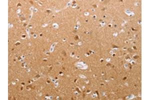 The image on the left is immunohistochemistry of paraffin-embedded Human brain tissue using ABIN7191852(PFN2 Antibody) at dilution 1/30, on the right is treated with synthetic peptide. (PFN2 antibody)