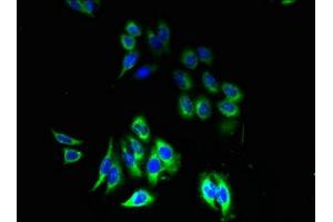 Immunofluorescent analysis of HepG2 cells using ABIN7162457 at dilution of 1:100 and Alexa Fluor 488-congugated AffiniPure Goat Anti-Rabbit IgG(H+L) (Purinergic Receptor P2Y, G-Protein Coupled, 13 (P2RY13) (AA 162-190) antibody)