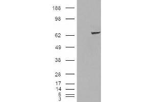 Western Blotting (WB) image for anti-Insulin-Like Growth Factor 2 mRNA Binding Protein 2 (IGF2BP2) antibody (ABIN5921444) (IGF2BP2 antibody)