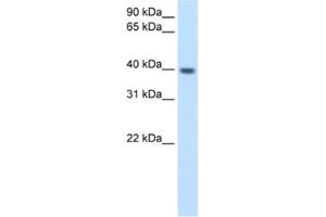 Western Blotting (WB) image for anti-Integrin beta 1 Binding Protein (Melusin) 2 (ITGB1BP2) antibody (ABIN2462574) (ITGB1BP2 antibody)
