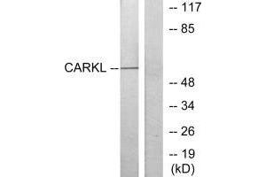 Western blot analysis of extracts from Jurkat cells, using CARKL antibody. (SHPK antibody  (N-Term))