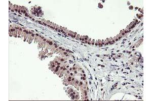 Immunohistochemical staining of paraffin-embedded Human breast tissue using anti-ZFP36 mouse monoclonal antibody. (ZFP36 antibody)