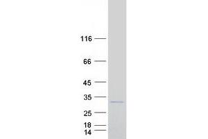 Validation with Western Blot