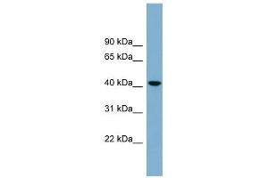 B4GALT2 antibody used at 1 ug/ml to detect target protein. (B4GALT2 antibody  (Middle Region))