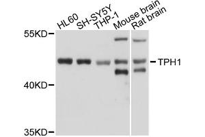 Western blot analysis of extracts of various cell lines, using TPH1 antibody (ABIN5970750) at 1/1000 dilution. (Tryptophan Hydroxylase 1 antibody)