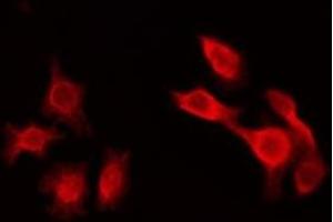 ABIN6275560 staining HepG2 by IF/ICC. (SHD antibody  (Internal Region))
