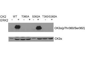 Western blot of CK2a(Phospho- Thr360/Ser362) antibody and CK2a antibody in vitro kinase assay. (CSNK2A1/CK II alpha antibody  (pSer362, pThr360))